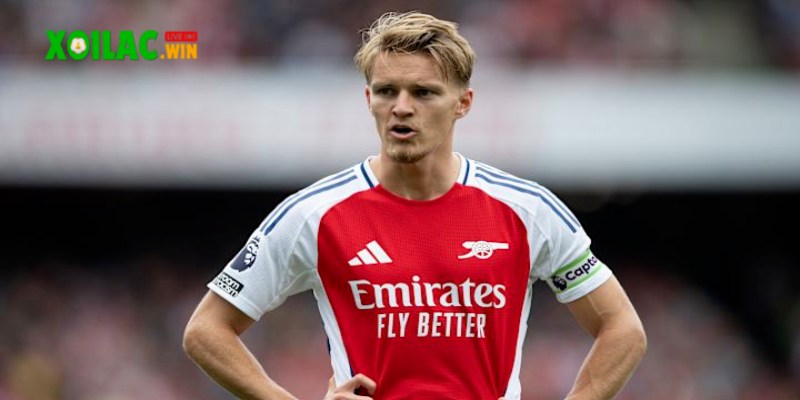 Odegaard chưa chắc chắn khi nào có thể ra sân cho Arsenal 